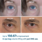 Dr. Melaxin Eyephalt Eye Bag Cream